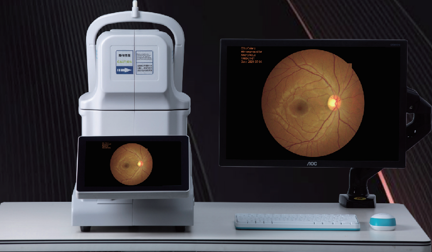 FUNDUS KAMERA